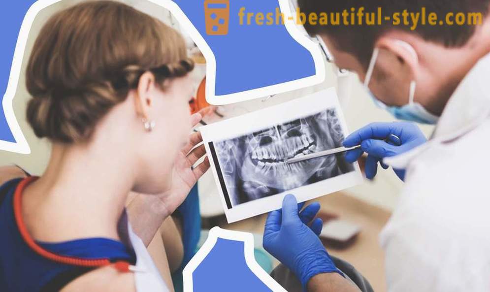 4 въпроси за зъбни импланти