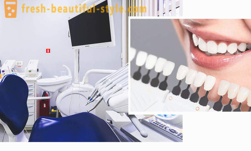 4, идеалният начин да се направи зъбите