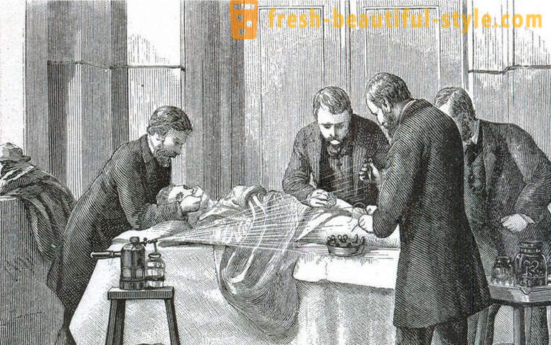Шокиращите факти за Викторианската хирургия
