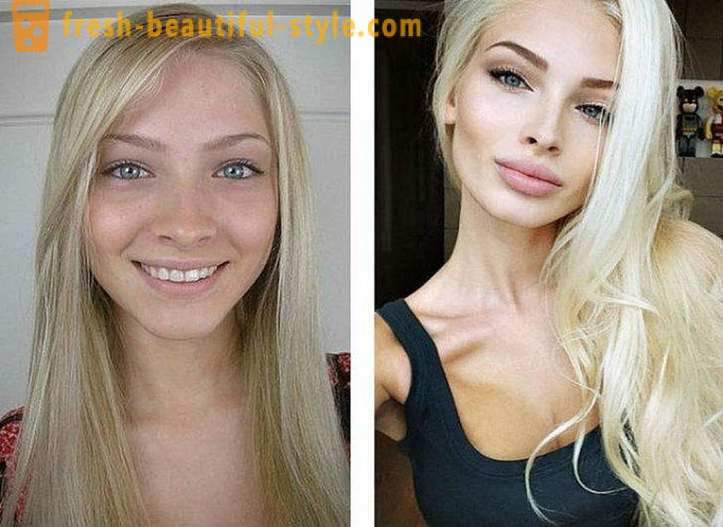 10 руски красавици преди и след пластмаса