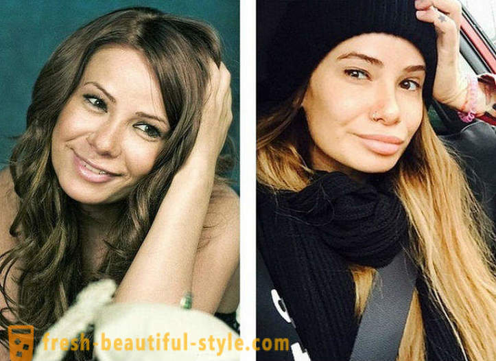 10 руски красавици преди и след пластмаса