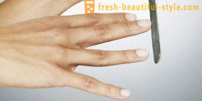 Бели петна по ноктите на пръстите на ръцете: на причините и лечението