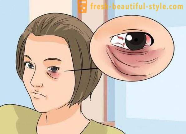Как да се прикрие с насинено око от удар: козметика, особено препоръки и