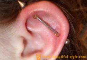 Пробиване на хрущяла на ухото: лечение, ефектите на