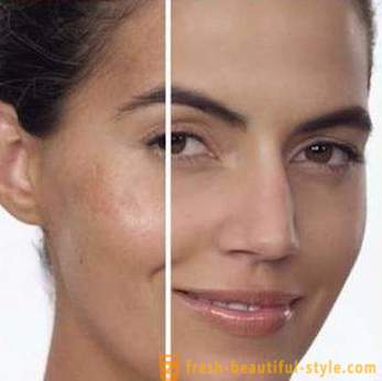 Избелващ крем на старчески петна по лицето: основните видове прегледи