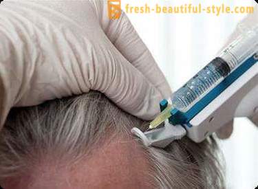 Мезотерапията за коса: грим инструменти и противопоказания