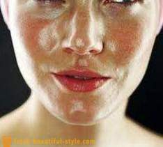 Мазната кожа на лицето: какво да направя, за да се справят с проблема?