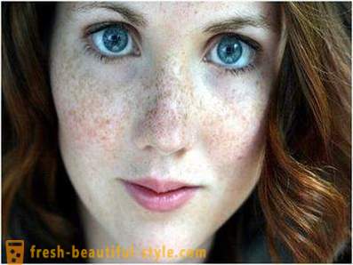 Погрижете се за своята красота и младост: предизвиква пигментацията по лицето